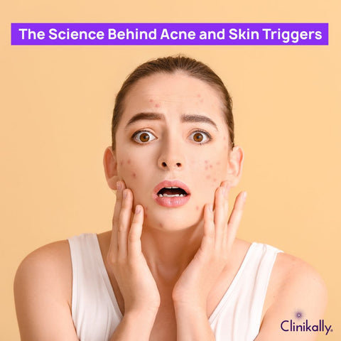 The Science Behind Acne and Skin Triggers