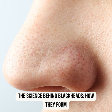 The Science Behind Blackheads: How They Form