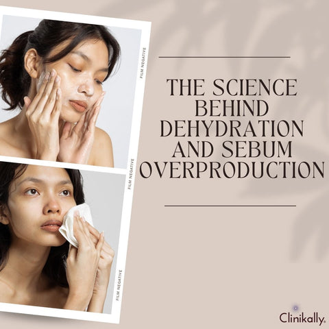 The Science Behind Dehydration and Sebum Overproduction