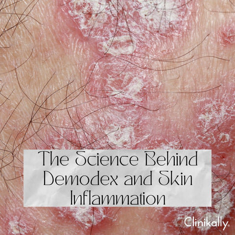 The Science Behind Demodex and Skin Inflammation