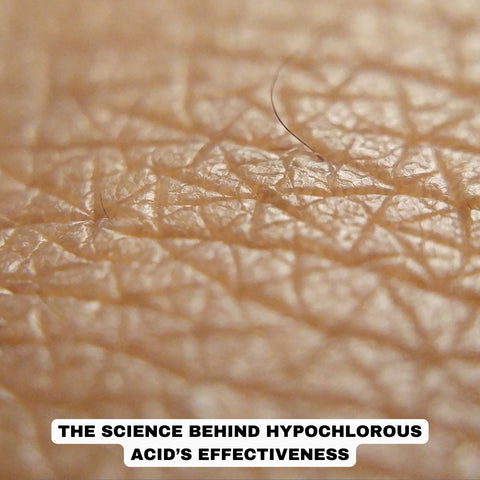 The Science Behind Hypochlorous Acid’s Effectiveness