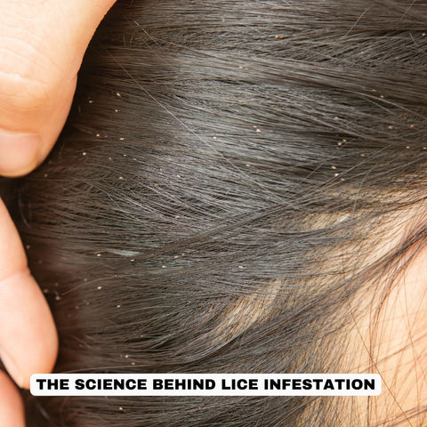 The Science Behind Lice Infestation
