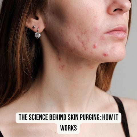 The Science Behind Skin Purging: How It Works