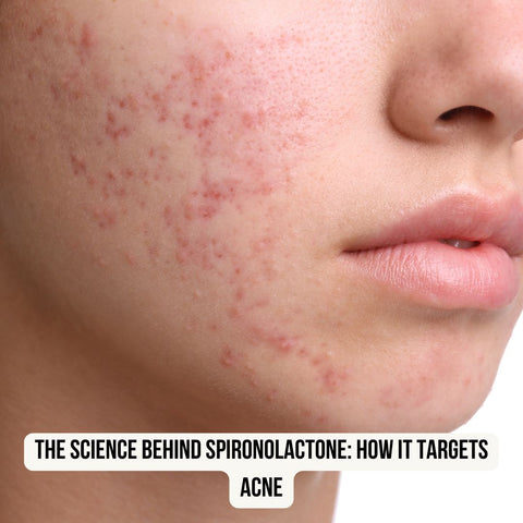 The Science Behind Spironolactone: How It Targets Acne