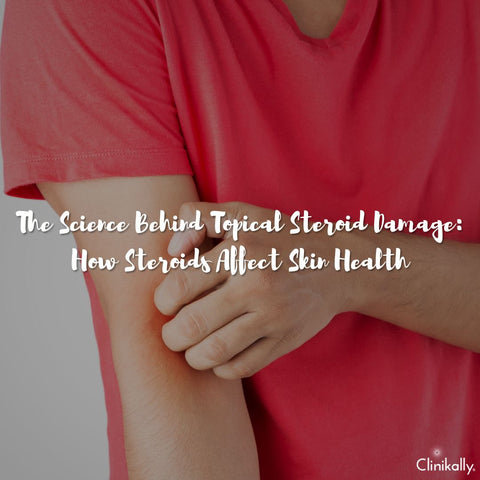 The Science Behind Topical Steroid Damage: How Steroids Affect Skin Health
