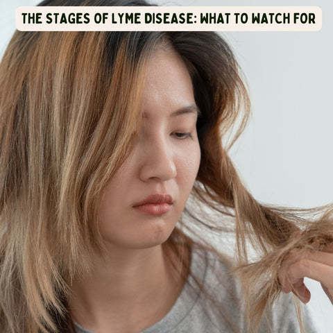 The Stages of Lyme Disease: What to Watch For