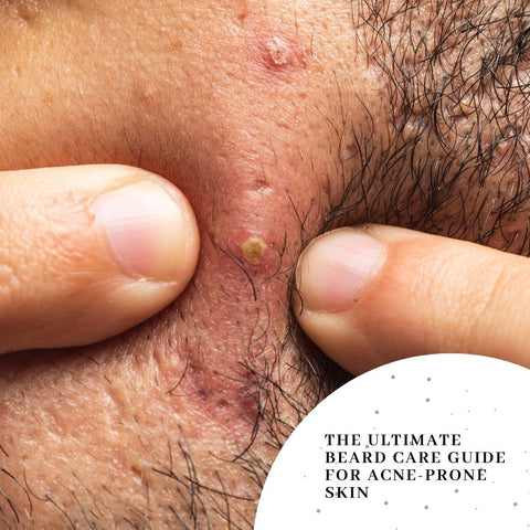 The Ultimate Beard Care Guide for Acne-Prone Skin