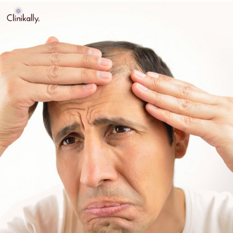 Does Pre-Workout Supplements Cause Hair Loss