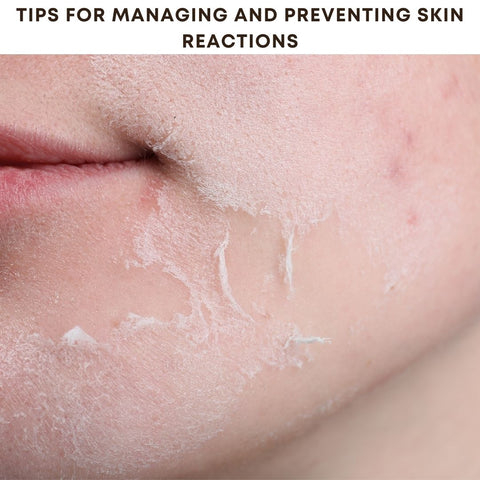 Tips for Managing and Preventing Skin Reactions