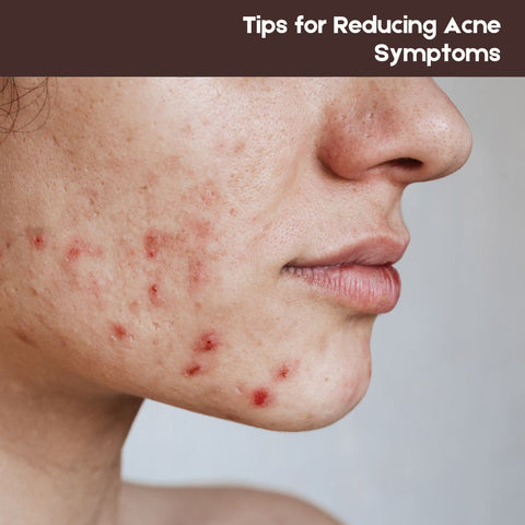 Tips for Reducing Acne Symptoms
