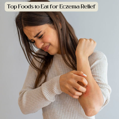 Top Foods to Eat for Eczema Relief