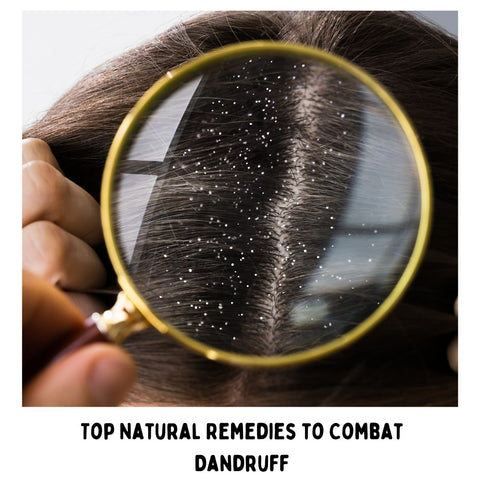 Top Natural Remedies to Combat Dandruff