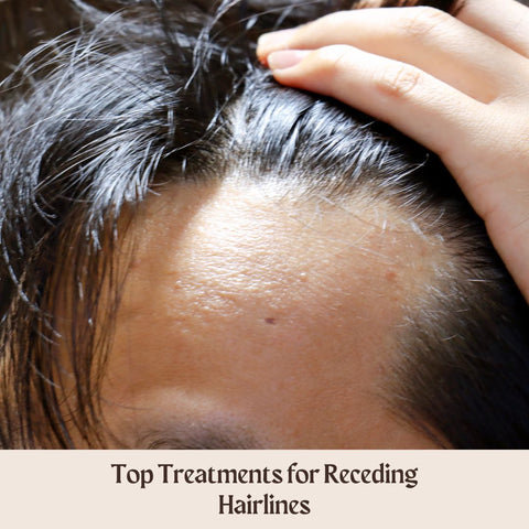 Top Treatments for Receding Hairlines