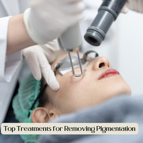 Top Treatments for Removing Pigmentation