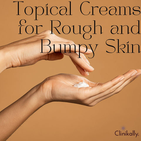 Topical Creams for Rough and Bumpy Skin