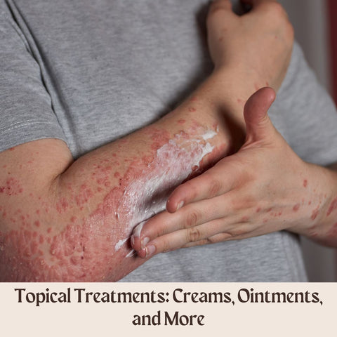 Topical Treatments: Creams, Ointments, and More
