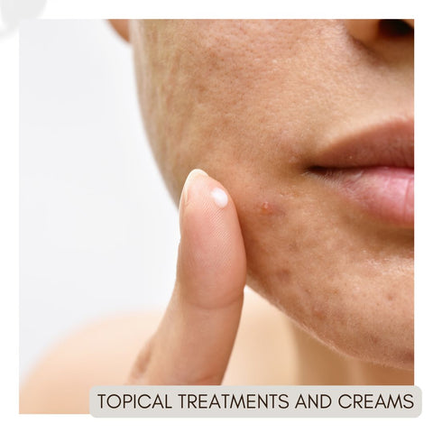 Topical Treatments and Creams