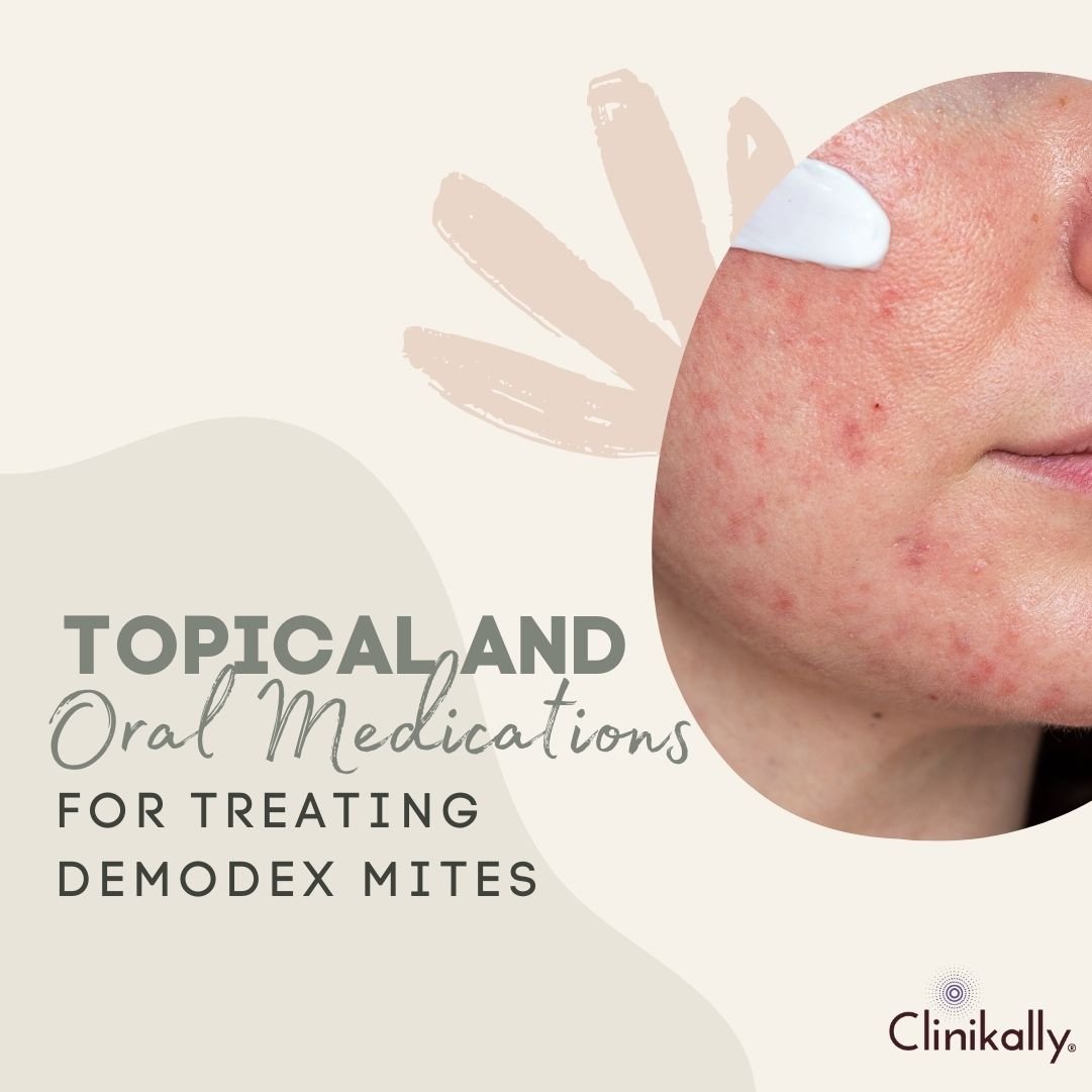 Topical and Oral Medications for Treating Demodex Mites