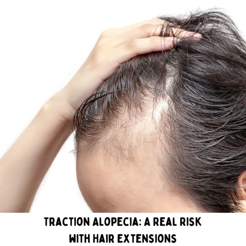 Traction Alopecia: A Real Risk with Hair Extensions