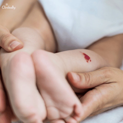 Infantile Hemangioma (Strawberry Birthmark)
