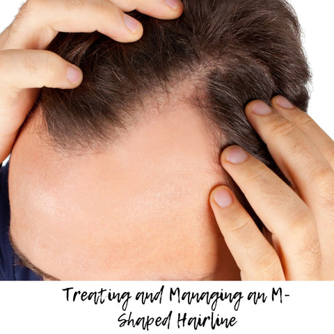 Treating and Managing an M-Shaped Hairline