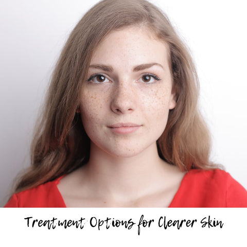 Treatment Options for Clearer Skin