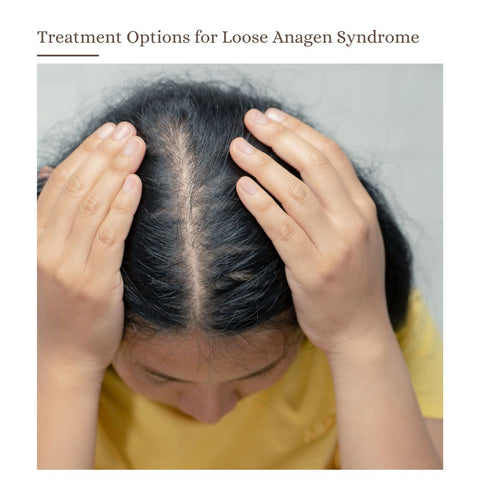 Treatment Options for Loose Anagen Syndrome