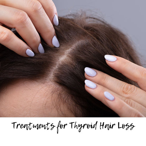Treatments for Thyroid Hair Loss
