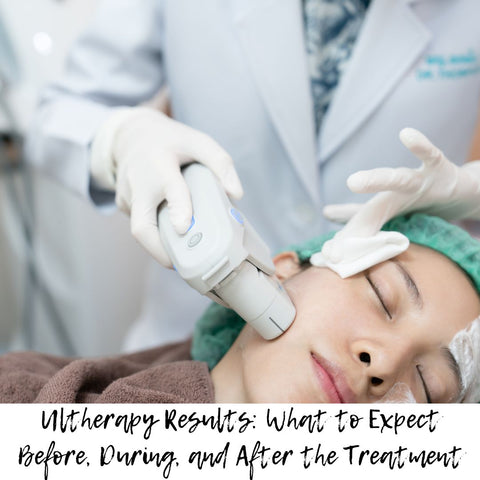 Ultherapy Results: What to Expect Before, During, and After the Treatment