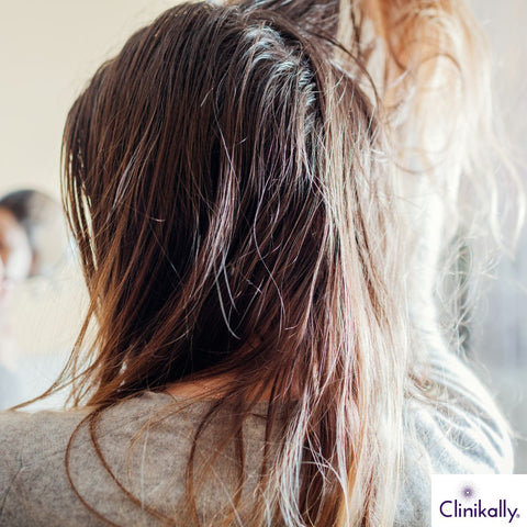 women showing greasy hair with oily roots close-up