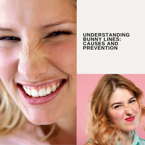 Understanding Bunny Lines: Causes and Prevention