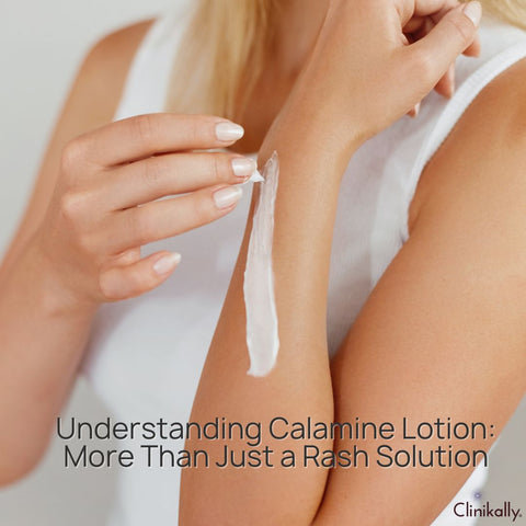 Understanding Calamine Lotion: More Than Just a Rash Solution