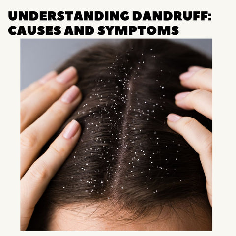 Understanding Dandruff: Causes and Symptoms