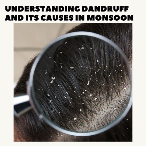 Understanding Dandruff and Its Causes in Monsoon