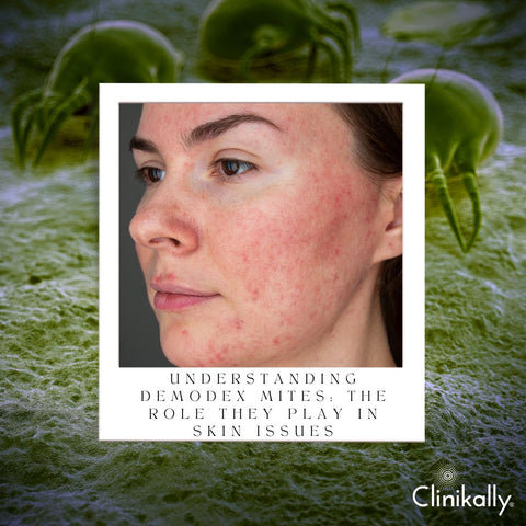 Understanding Demodex Mites: The Role They Play in Skin Issues