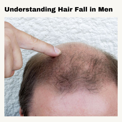 Understanding Hair Fall in Men