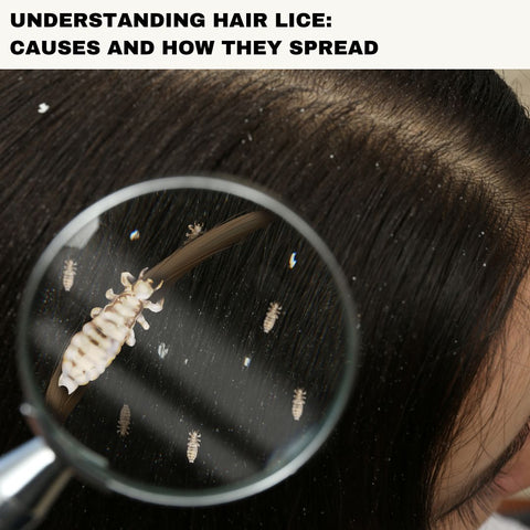 Understanding Hair Lice: Causes and How They Spread