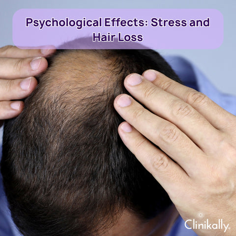 Psychological Effects: Stress and Hair Loss