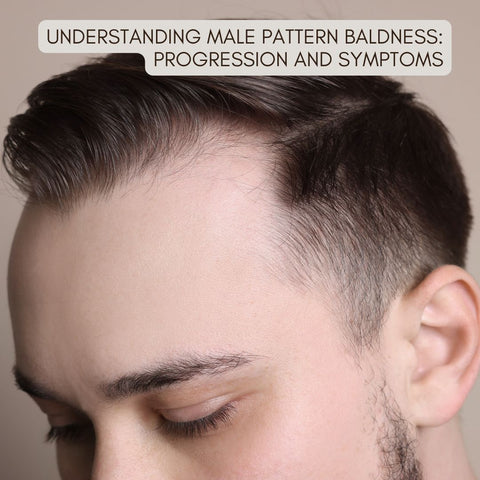 Understanding Male Pattern Baldness: Progression and Symptoms