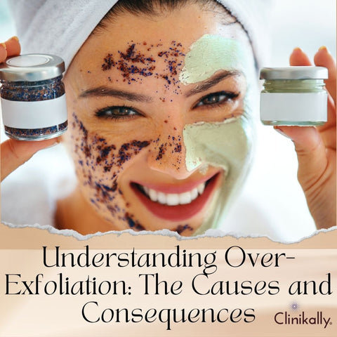 Understanding Over-Exfoliation: The Causes and Consequences