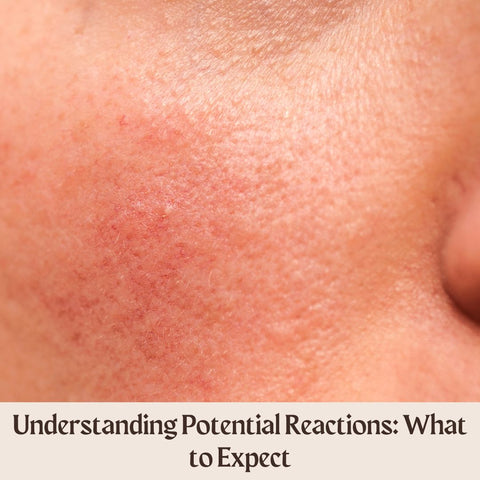 Understanding Potential Reactions: What to Expect