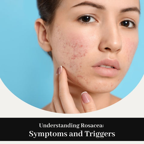Understanding Rosacea: Symptoms and Triggers