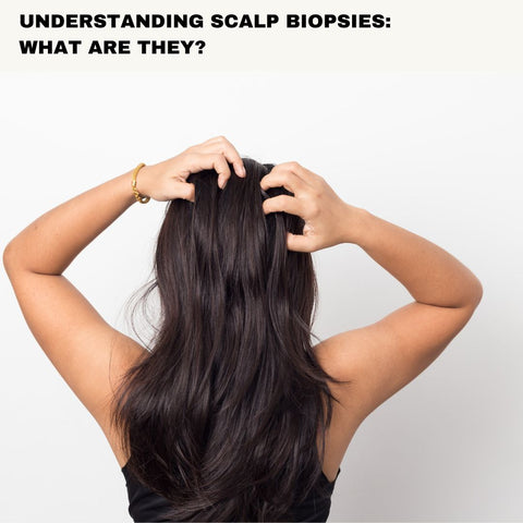 Understanding Scalp Biopsies: What Are They?