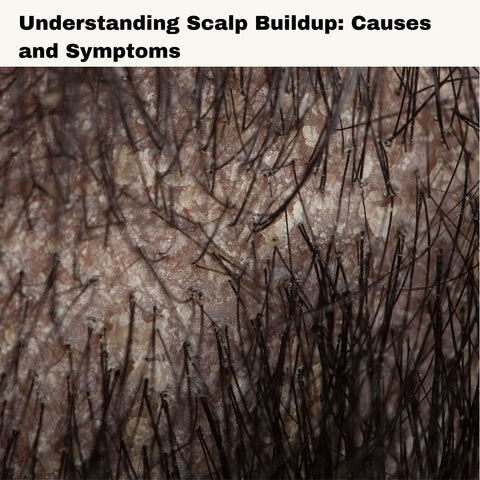 Understanding Scalp Buildup: Causes and Symptoms