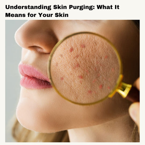 Understanding Skin Purging: What It Means for Your Skin
