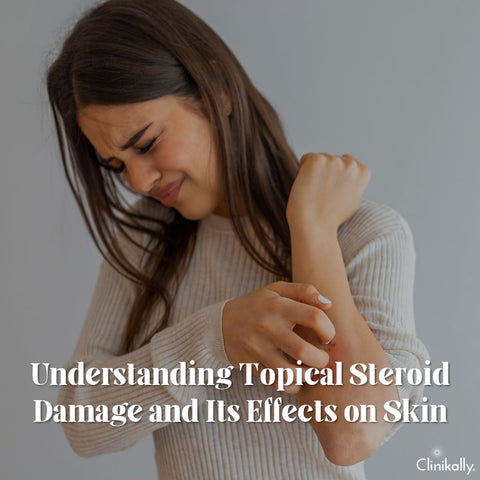 Understanding Topical Steroid Damage and Its Effects on Skin