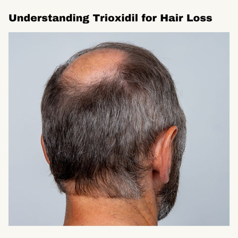 Understanding Trioxidil for Hair Loss