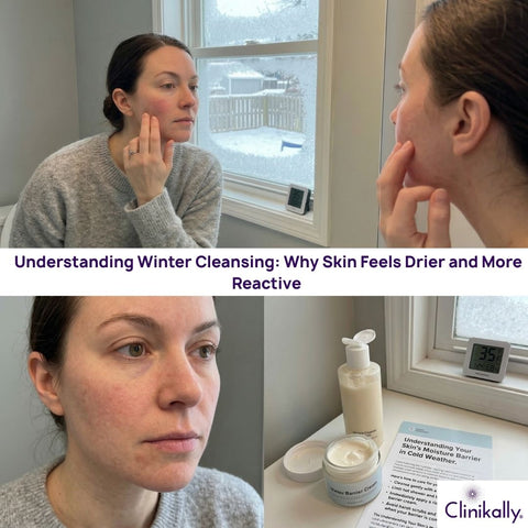 A lady with dry skin and redness on her face