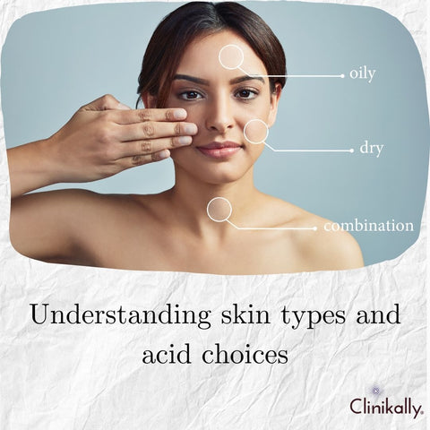 Understanding skin types and acid choices