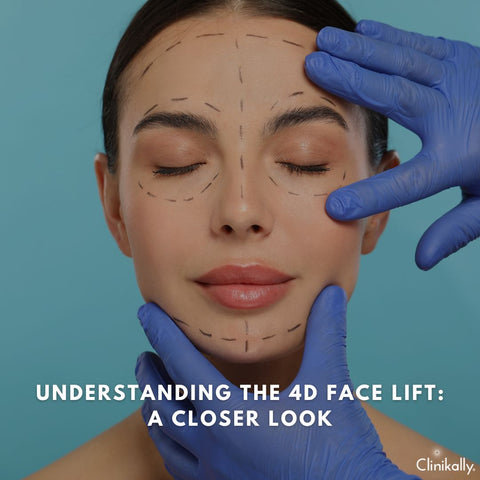 Understanding the 4D Face Lift: A Closer Look